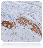 CD56; Clone 123C3 (Concentrate)