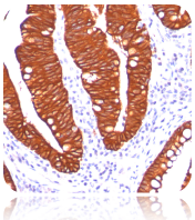 Cytokeratin 19; Clone A53-B/A2.26 (Ready-To-Use)