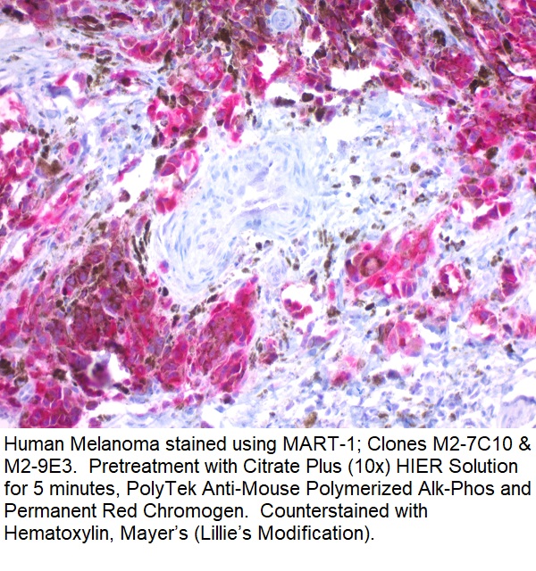 MART-1; Clones M2-7C10 & M2-9E3 (Ready-To-Use)