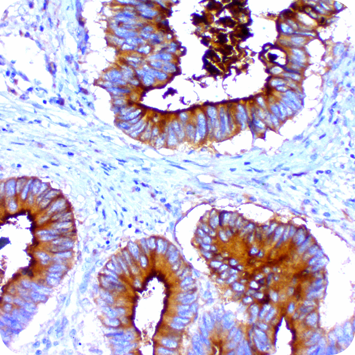 Carcinoembryonic Antigen, Pan (CEA); Clone COL-1 (Ready-To-Use)