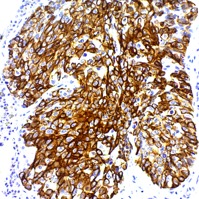 Cytokeratin 5,6 Cocktail; Clones EP42 & EP67 (Ready-To-Use)