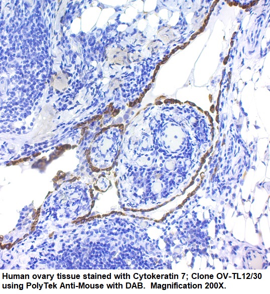 Cytokeratin 7; Clone OV-TL12/30 (Concentrate)