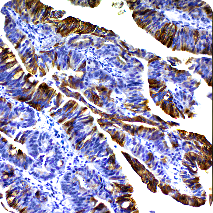 Cytokeratin 20; Clone EP23 (Ready-To-Use)