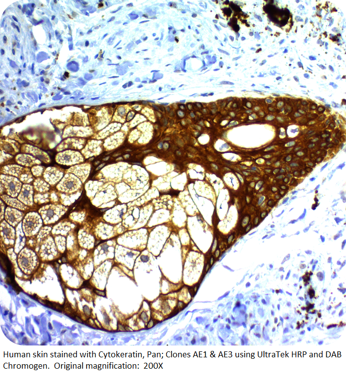 Cytokeratin, Pan; Clones AE1 & AE3 (Ready-To-Use)