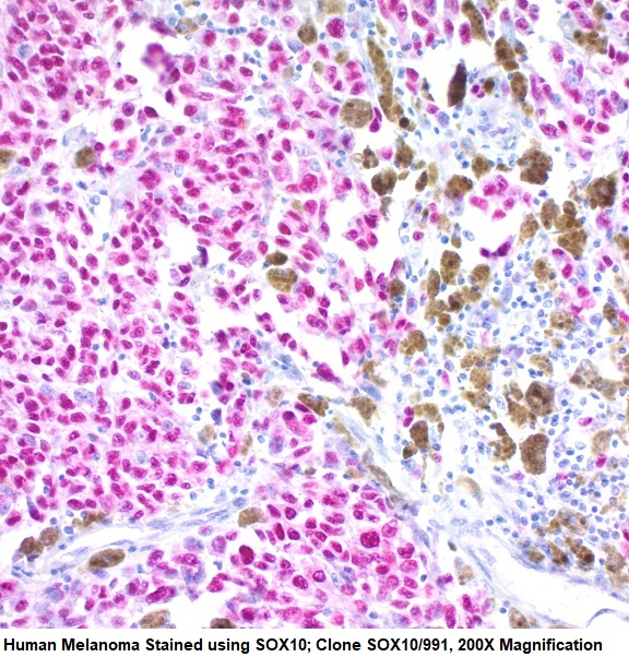 SOX10; Clone SOX10/991 (Concentrate)