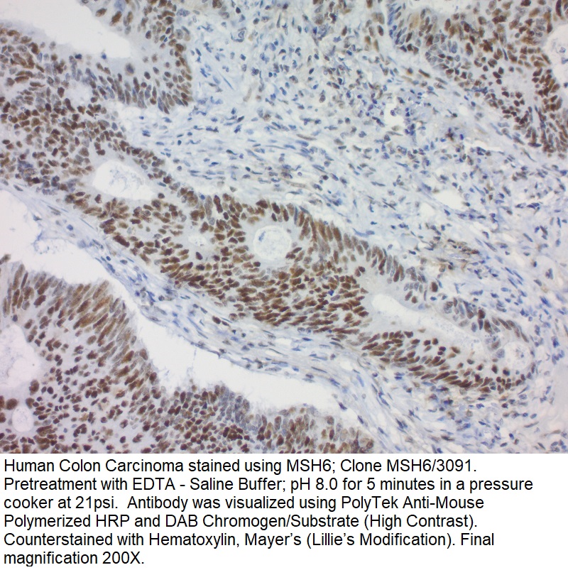 MSH6; Clone MSH6/3091 (Concentrate)