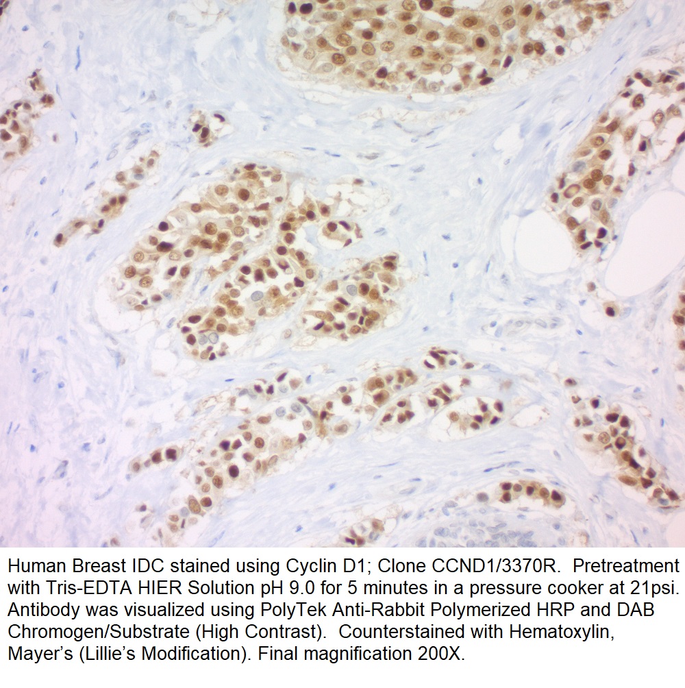 Cyclin D1; Clone CCND1/3370R (Concentrate)