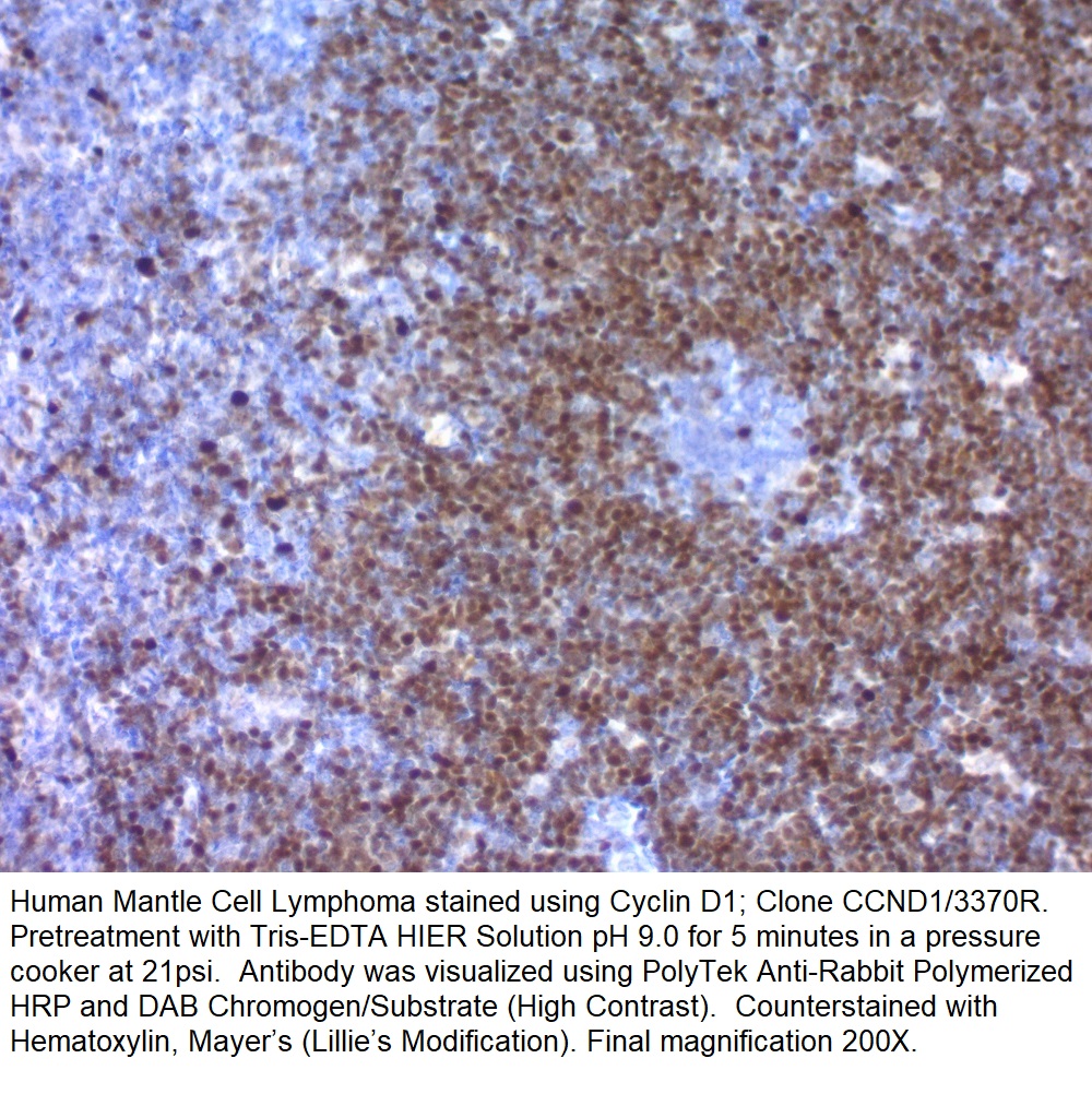 Cyclin D1; Clone CCND1/3370R (Concentrate)