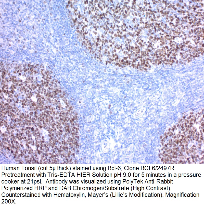 Bcl-6; Clone BCL6/2497R (Concentrate)