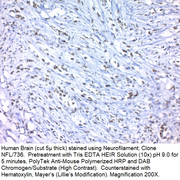 Neurofilament; Clone NFL/736 (Ready-To-Use)