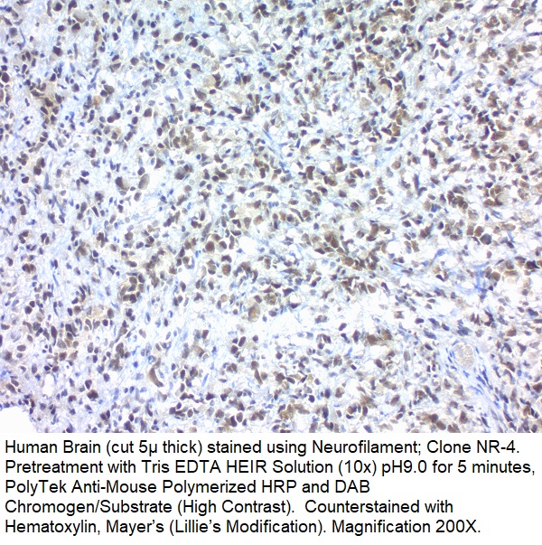 Neurofilament; Clone NR-4 (Ready-To-Use)