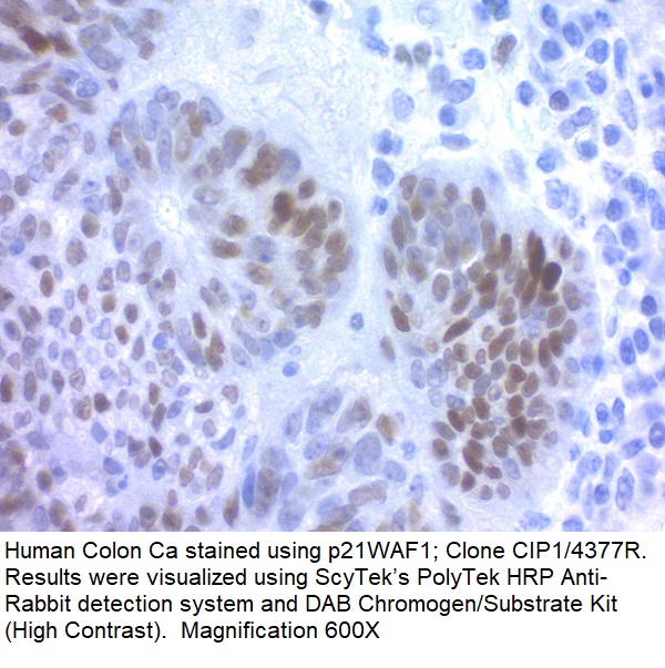 p21WAF1; Clone CIP1/4377R (Ready-To-Use)