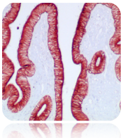 AEC Chromogen/Substrate Kit