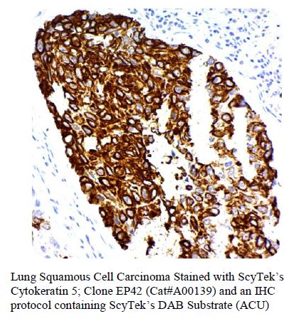 DAB Chromogen/Substrate Kit