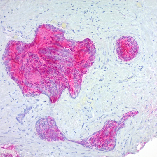 SensiTek Alk-Phos Anti-Polyvalent (Permanent Red) Staining System