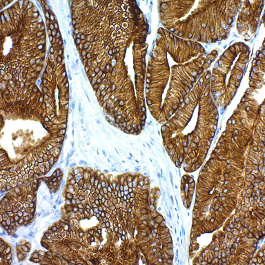 UltraTek HRP Anti-Polyvalent Staining System