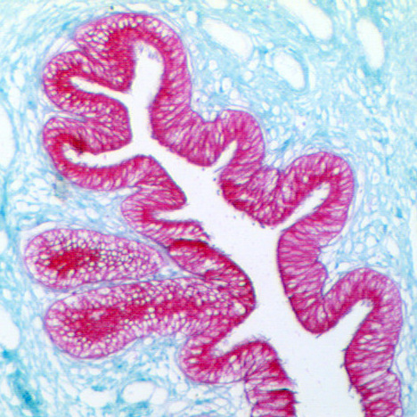 UltraTek Alk-Phos Anti-Polyvalent (Permanent Red) Staining System