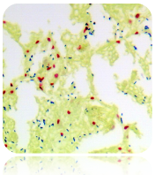 Gram Stain Kit (Modified Brown & Brenn)