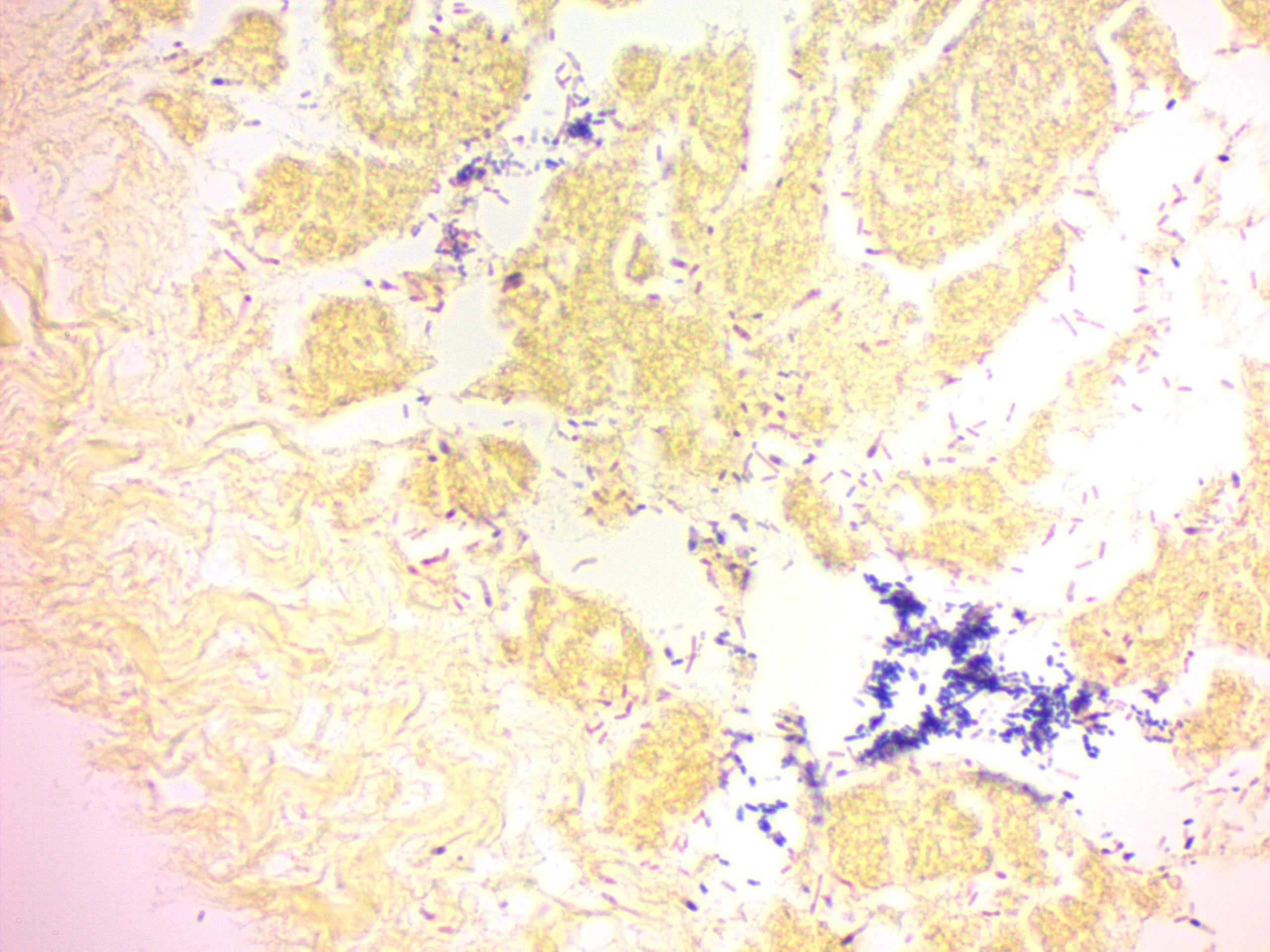 Gram Stain Kit (Modified Brown & Brenn)