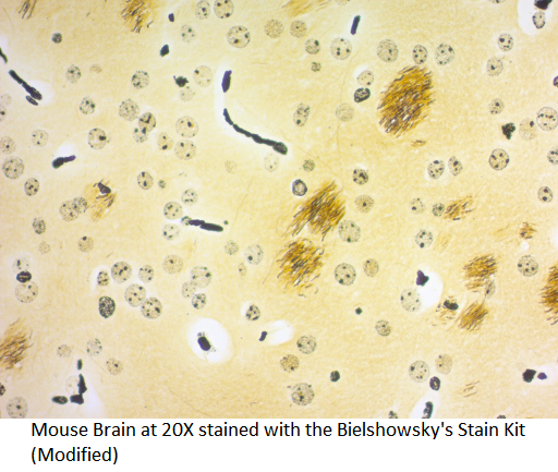 Bielshowsky's Stain Kit (Modified)