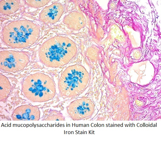 Colloidal Iron Stock Solution