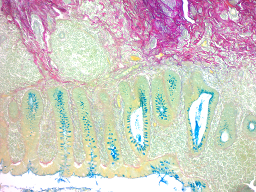 Colloidal Iron Stain Kit