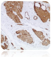 CRF Anti-Polyvalent HRP Polymer (DAB) Stain Kit