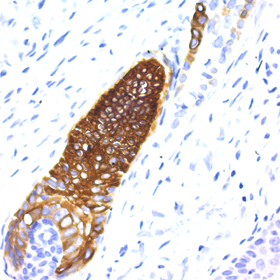 CRF Anti-Polyvalent HRP Polymer (DAB) Lab Pack