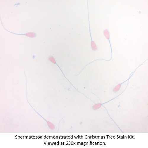 Christmas Tree Stain Kit