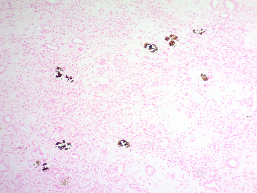 Calcium Stain Kit (Modified Von Kossa)