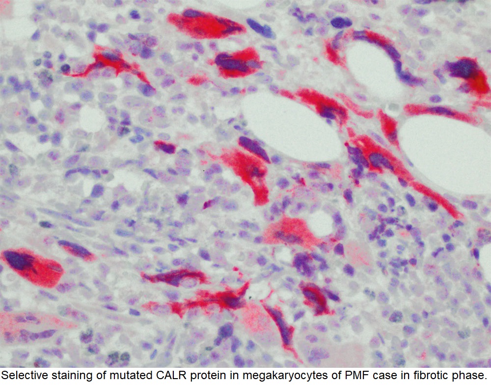 Calreticulin Mutation / CALR; Clone CAL2 (Concentrate)