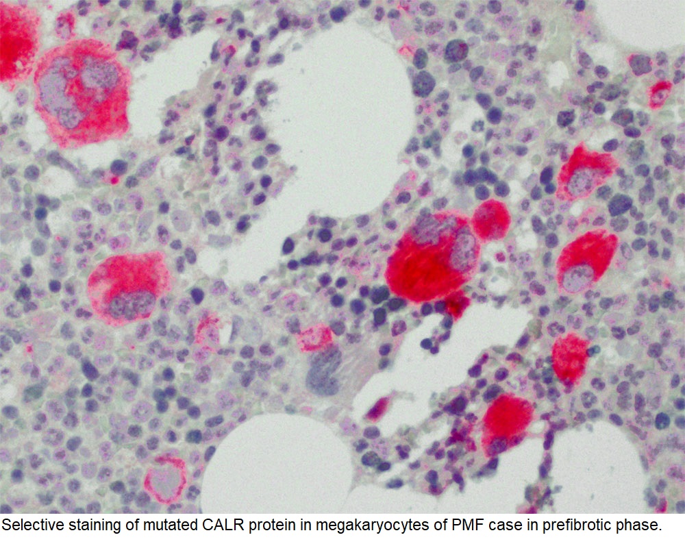 Calreticulin Mutation / CALR; Clone CAL2 (Concentrate)