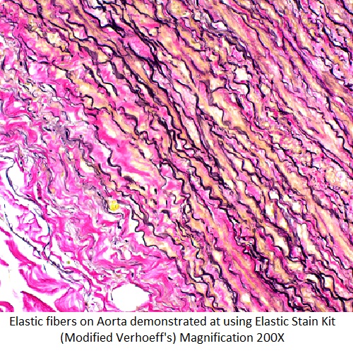 Elastic Control Slides