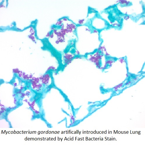 Acid Fast Bacteria Control Slides