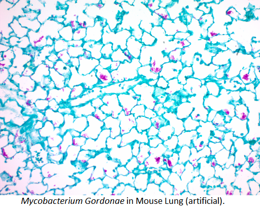 Carbol Fuchsin Solution