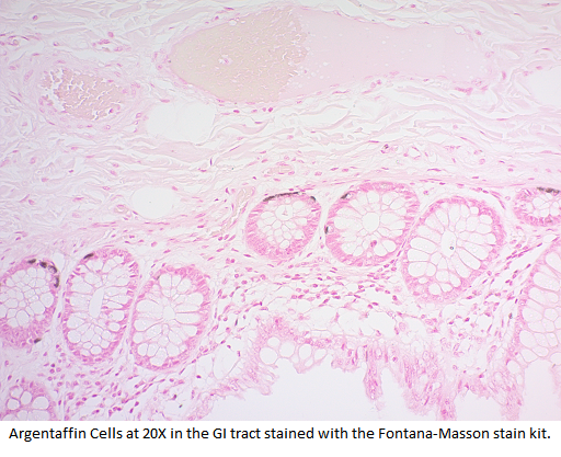 Fontana-Masson Stain Kit (For Argentaffin Cells and Melanin)