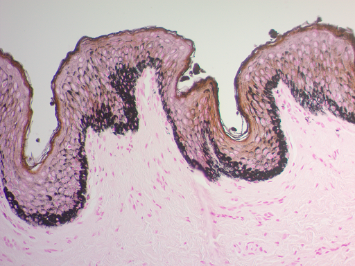 Fontana-Masson Stain Kit (For Argentaffin Cells and Melanin)