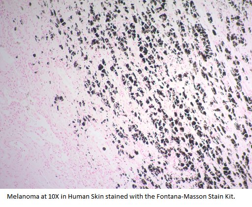 Fontana-Masson Stain Kit (For Argentaffin Cells and Melanin)