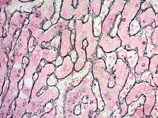 Reticulum Stain Kit  (Modified Gomori's)