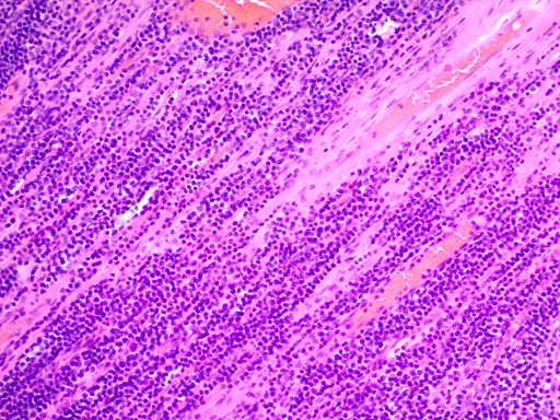 Hematoxylin and Eosin Stain Kit