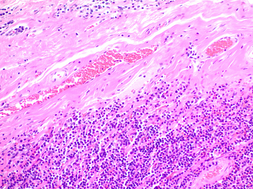 Hematoxylin and Eosin Stain Kit