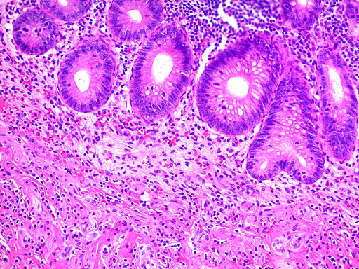 Hematoxylin and Eosin Stain Kit