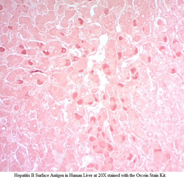 Orcein Stain Kit (For Hepatitis B and Elastic Fibers)