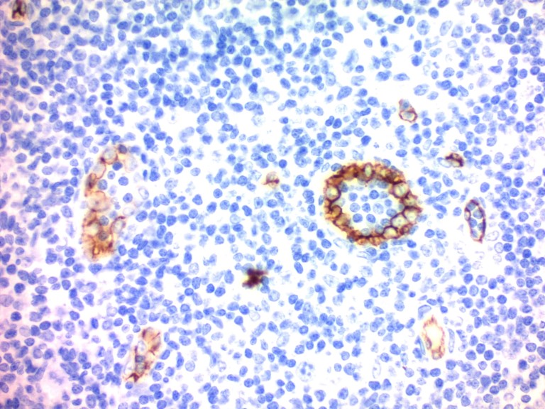 Hematoxylin, Mayer's (Lillie's Modification)