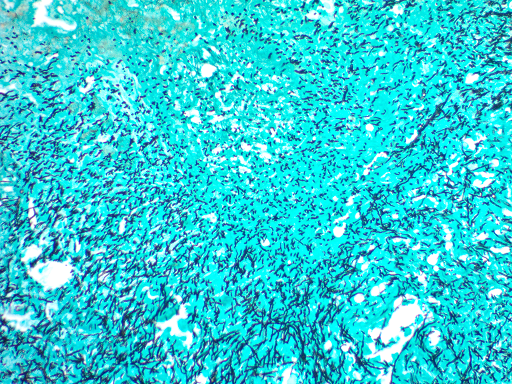 GMS Stain Kit