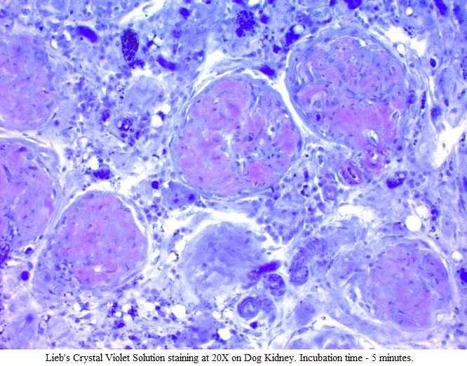 Lieb's Crystal Violet for Amyloid (0.5%)