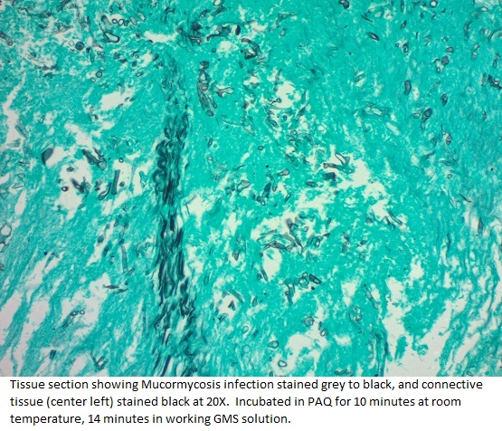 GMS Stain Kit with Periodic Acid