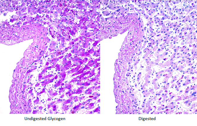 Periodic Acid Schiff (PAS) Diastase Stain Kit