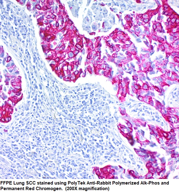 PolyTek, Anti-Rabbit Polymerized Alk-Phos