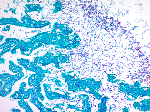 Periodic Acid Schiff (PAS) for Fungus Stain Kit